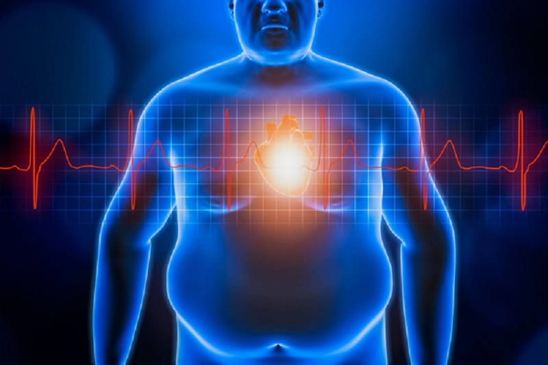 آیا چاقی و بیماری های قلبی و عروقی بهم ارتباط دارند؟