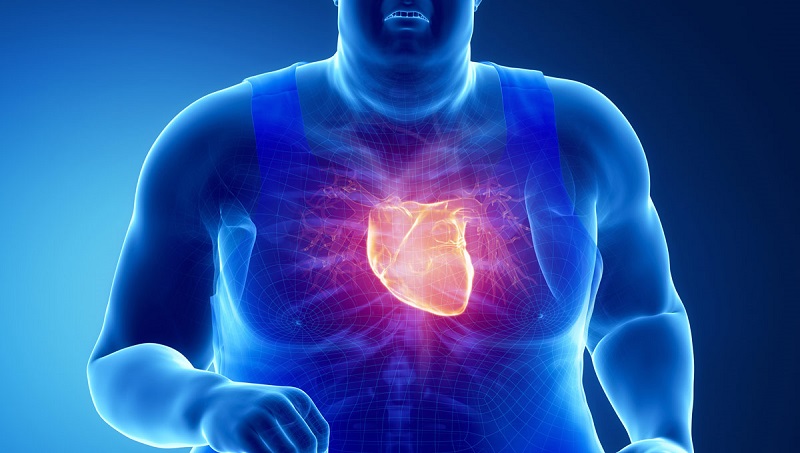 آیا چاقی و بیماری های قلبی و عروقی بهم ارتباط دارند؟